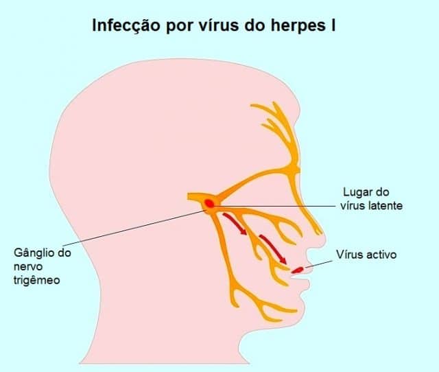 Oral sex with someone with herpes