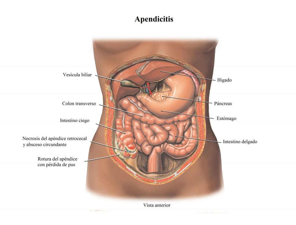 Dolor En El Lado Derecho Del Abdomen Costado Y Espalda Debajo De Las