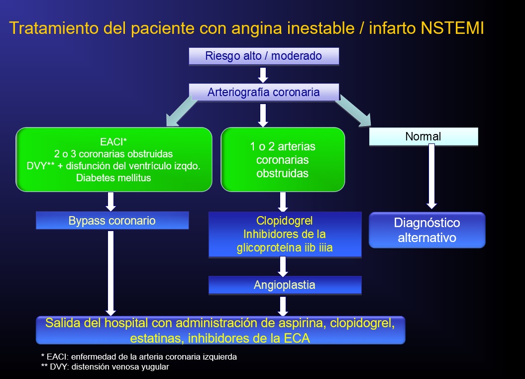 Infarto Agudo De Miocardio Tratamiento