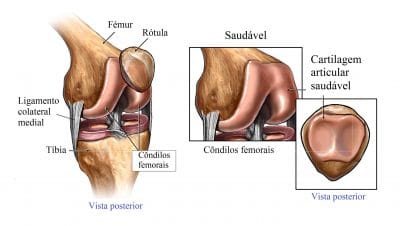 Anatomia Do Joelho Ligamentos Articula O M Sculos E Meniscos