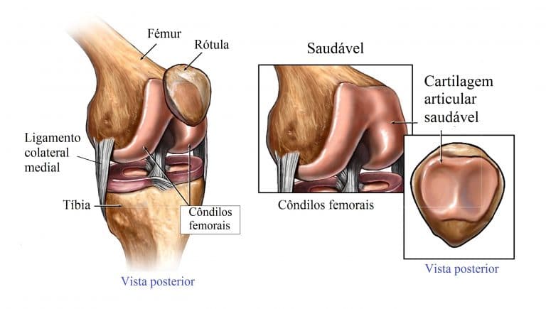 Anatomia Do Joelho Ligamentos Articula O M Sculos E Meniscos