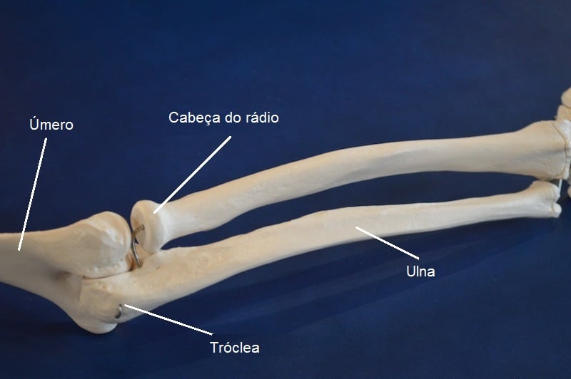 Fratura Da Ulna E R Dio Sem Desvio Reabilita O E Tempo De Recupera O