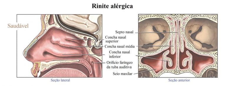 Como hidratar la nariz por dentro