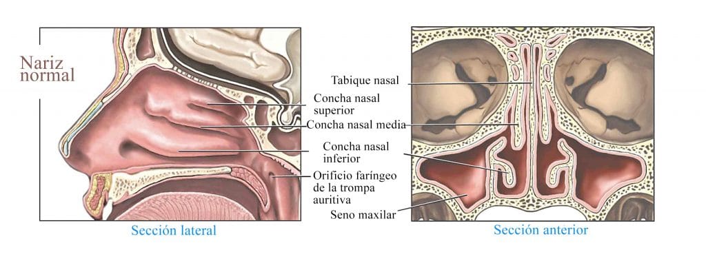 Sinusitis Wikipedia